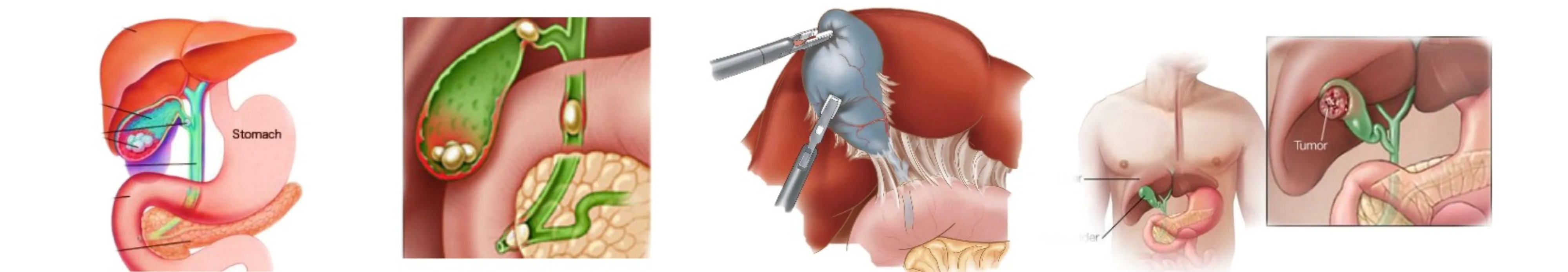 gall bladder